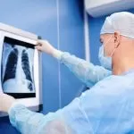 Cancro al polmone, nuovi farmaci sperimentati al San Luigi