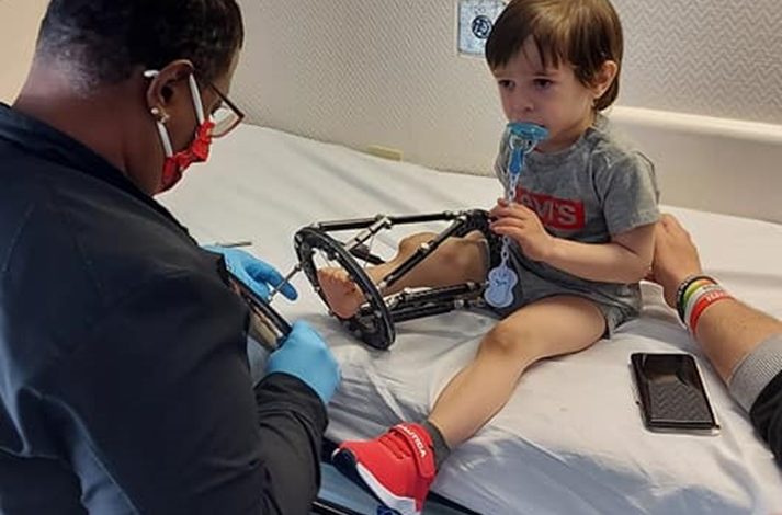 Il piccolo Kevin, il bambino nato senza tibia e rotula potrà camminare: operazione riuscita